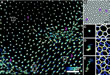 tracked trajectories: elastic and plastic deformation in ring exchange