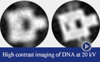 DNA at 20 kV